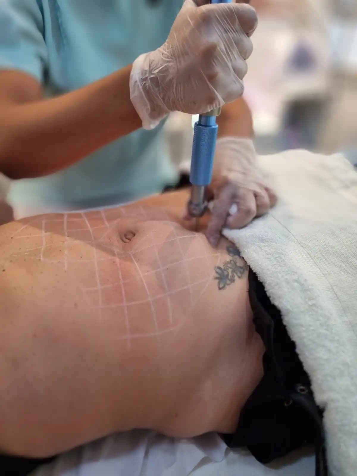 Enzimas local e metabólica